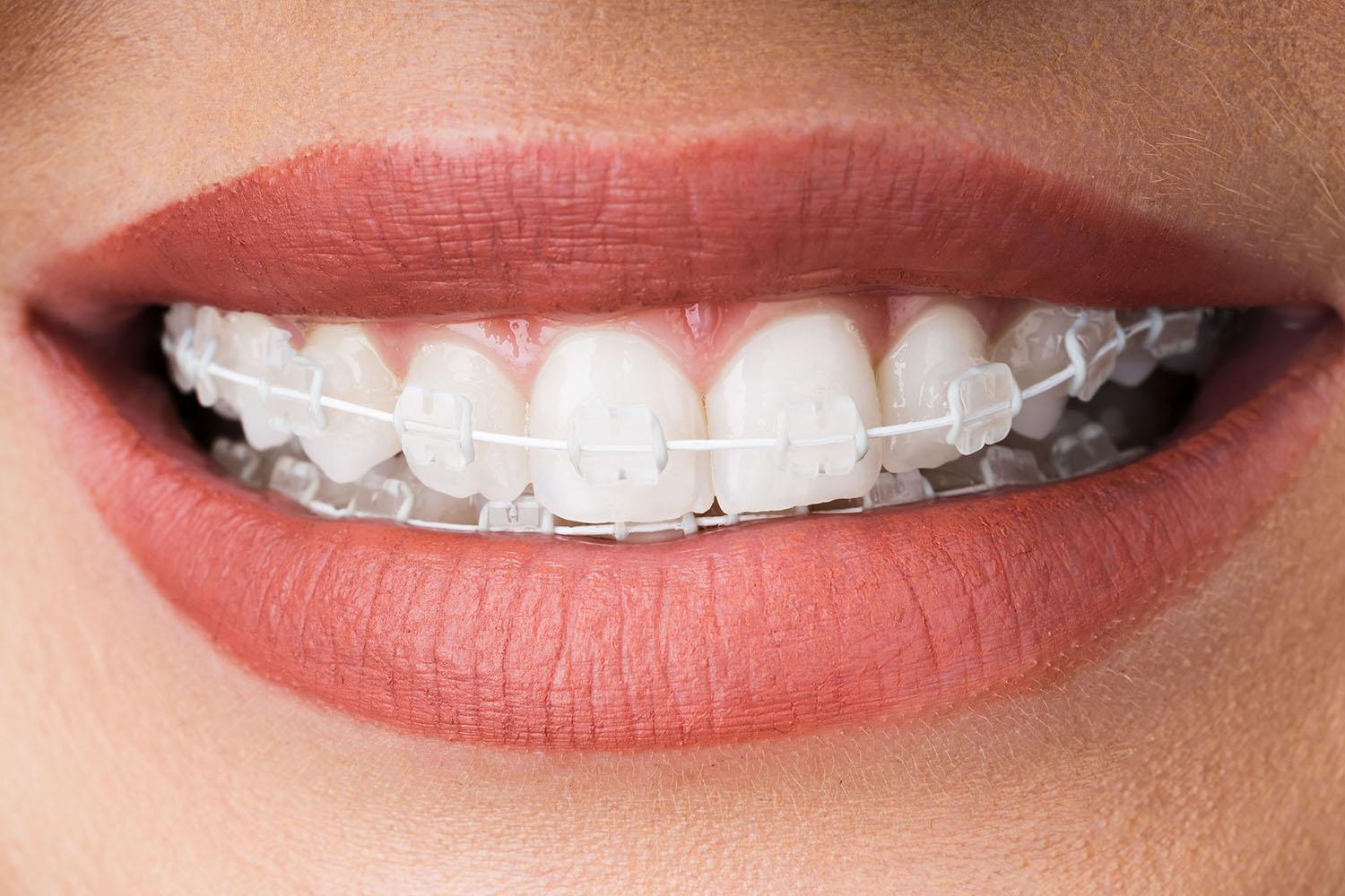 Orthodontics
