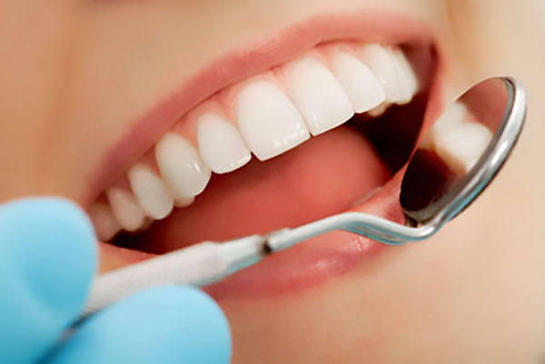 Smile Makeover